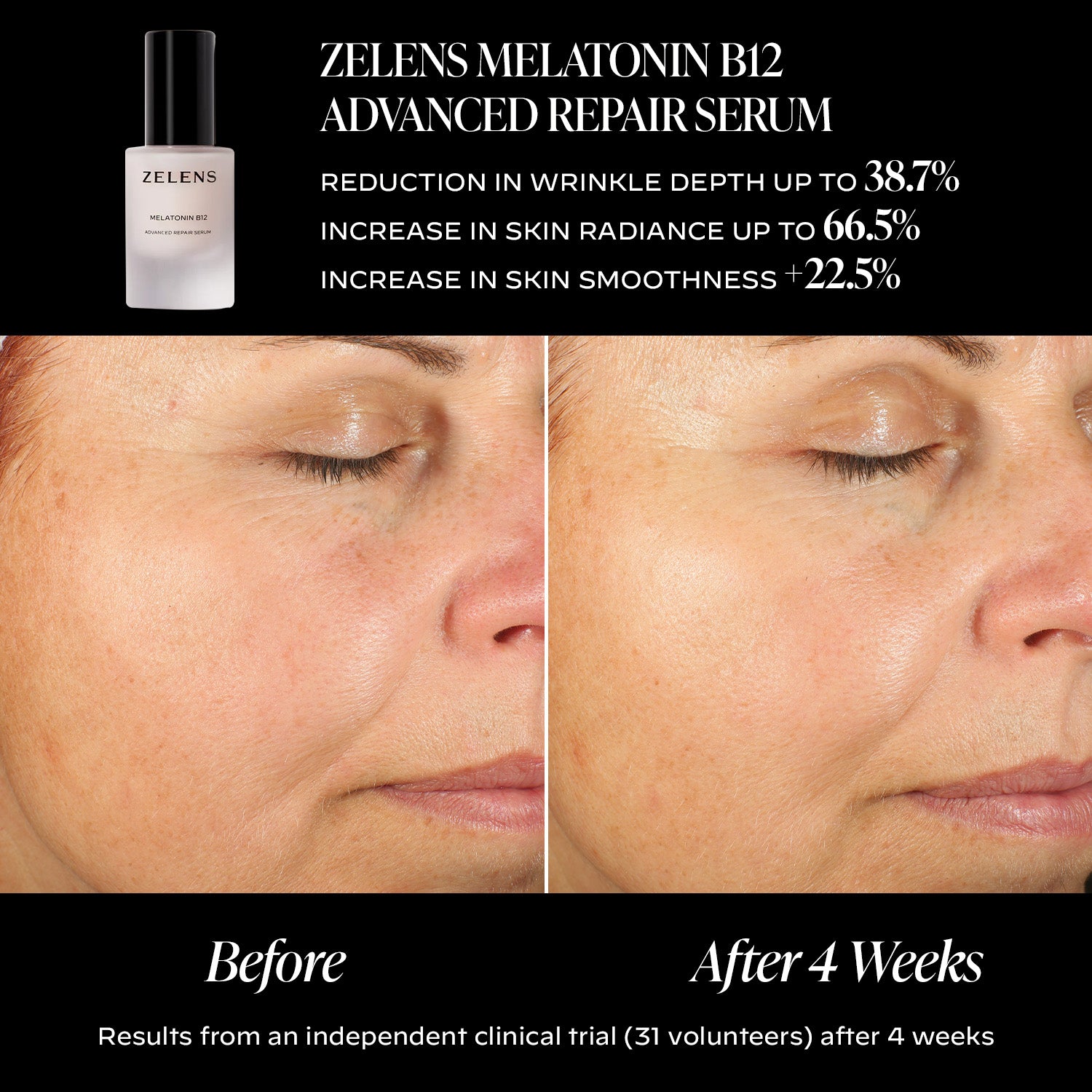 Melatonin B12 - Advanced Repair Serum